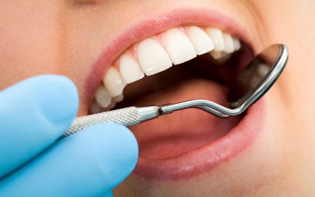 Como cuidar de tus implantes dentales