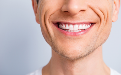 ¿Qué es la maloclusión dental? Causas, Tipos y Cuidados