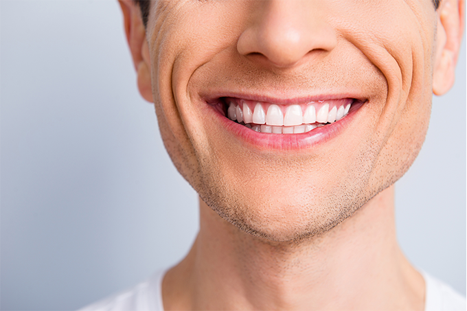¿Qué es la maloclusión dental? Causas, Tipos y Cuidados