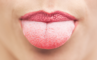 ¿Qué nos dice la lengua sobre el estado de salud?